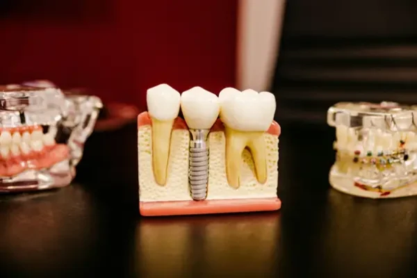 3Shape Dental Scanners for Sale