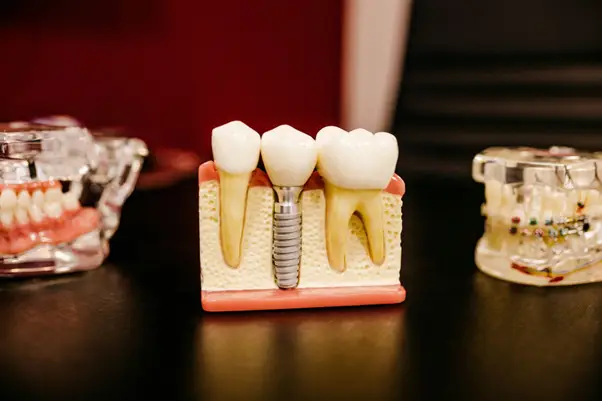 3Shape Dental Scanners for Sale