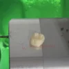 CEREC MC XL for sale