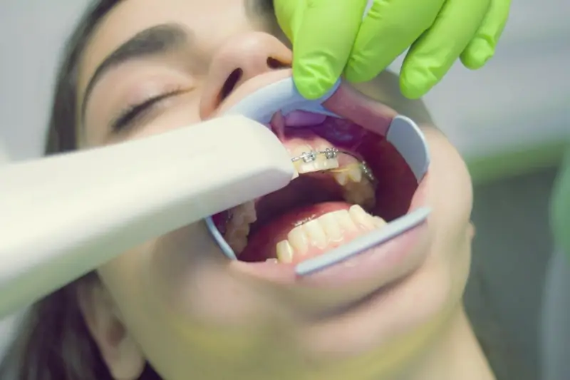Carestream Dental Imaging